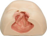 Left clift lip plate
